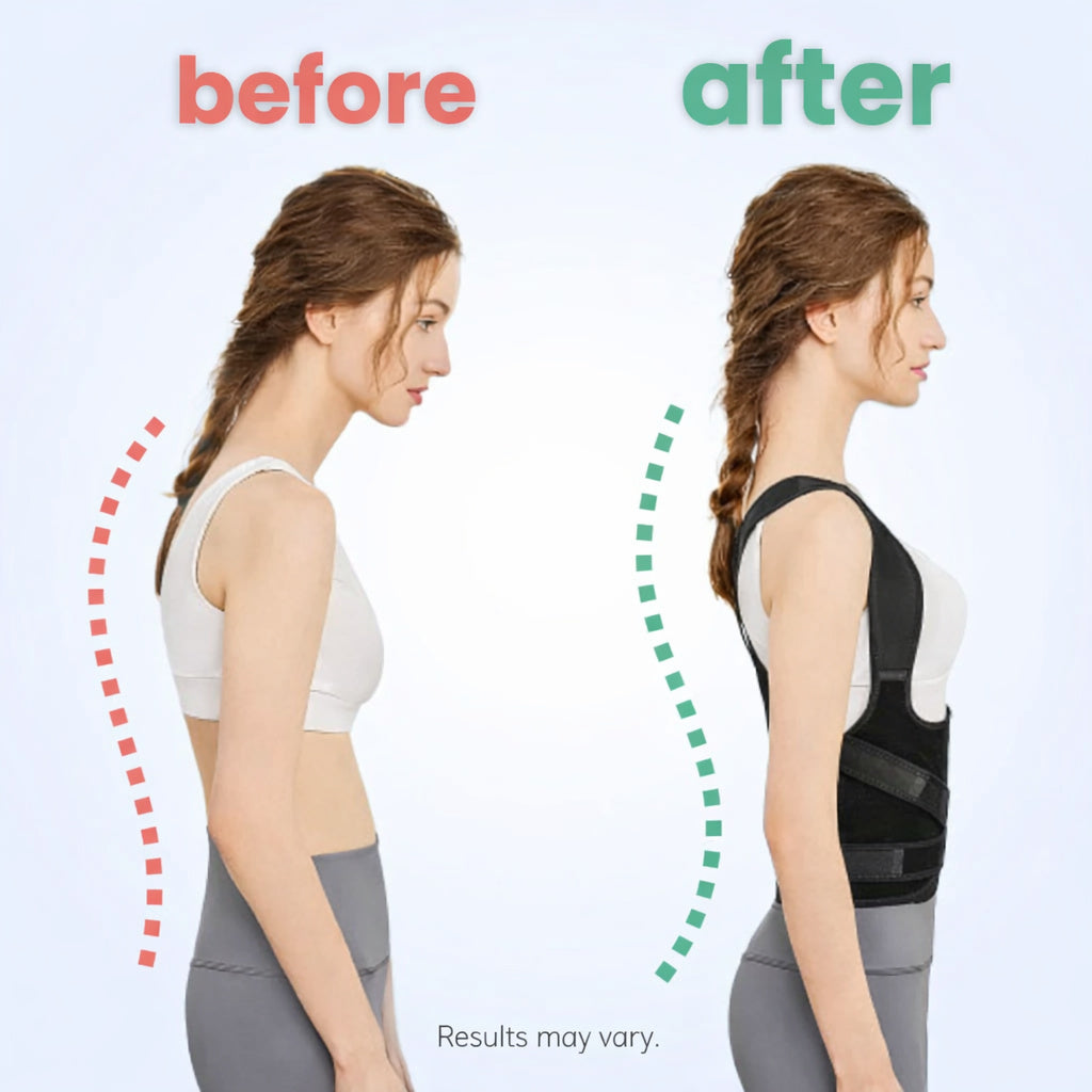 Side-view comparison of a woman standing without and with the Revitalize posture corrector.